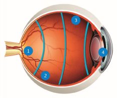 Zones 3 mirror lens
