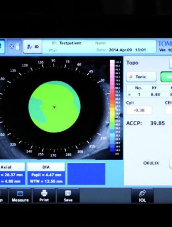 OA 2000 Topo screen