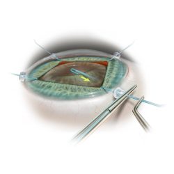 Iris hook800x800