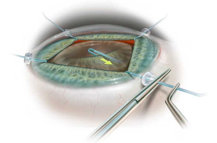 Iris hook800x800